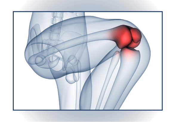 Knee Cartilage