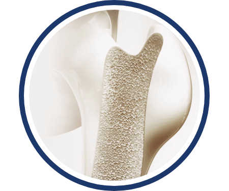 Bone