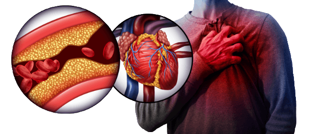 Advanced Cholesterol Formula Header