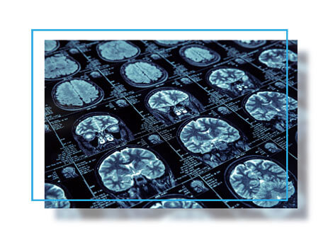 MRI