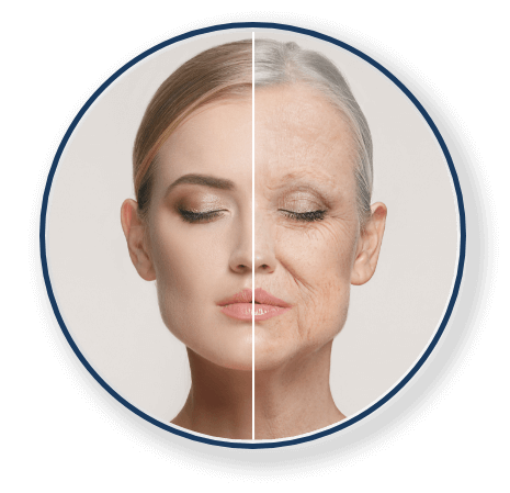 Limit Aging
