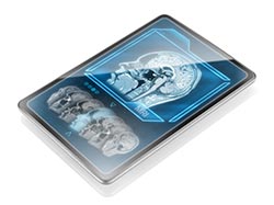 fMRI Brain Scan