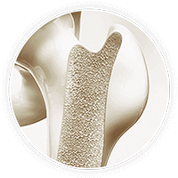 Bone