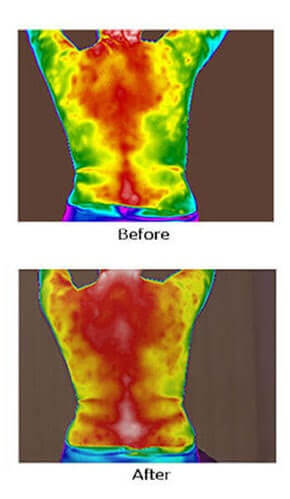 Thermal scans