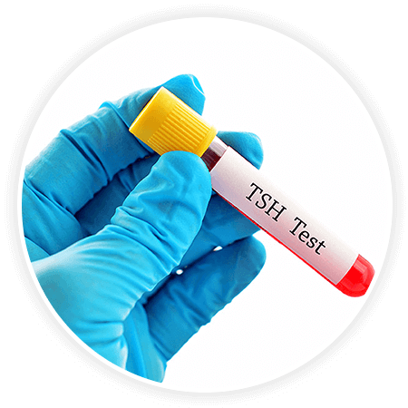 TSH test